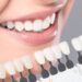 Clareamento Dental | Odontologia Giordano | Dentista em Sorocaba